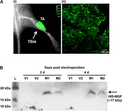 Overexpression of Mechano-Growth Factor Modulates Inflammatory Cytokine Expression and Macrophage Resolution in Skeletal Muscle Injury